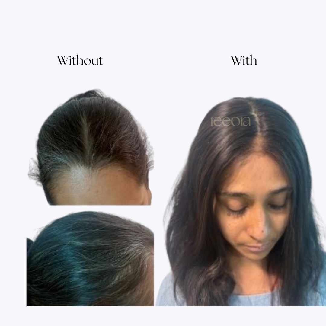 Frontline Hair Topper - Wide | Hairline Thinning & Grey Coverage | Lace & Silk