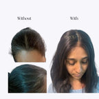 Frontline Hair Topper - Narrow | Hairline Thinning & Grey Coverage | Lace & Silk
