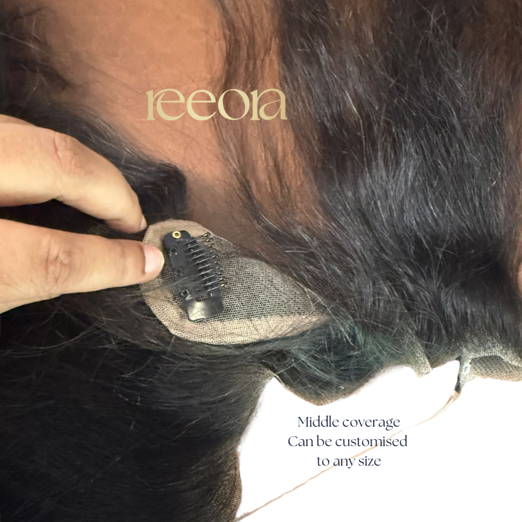 Receeding Hairline with Slim Topper