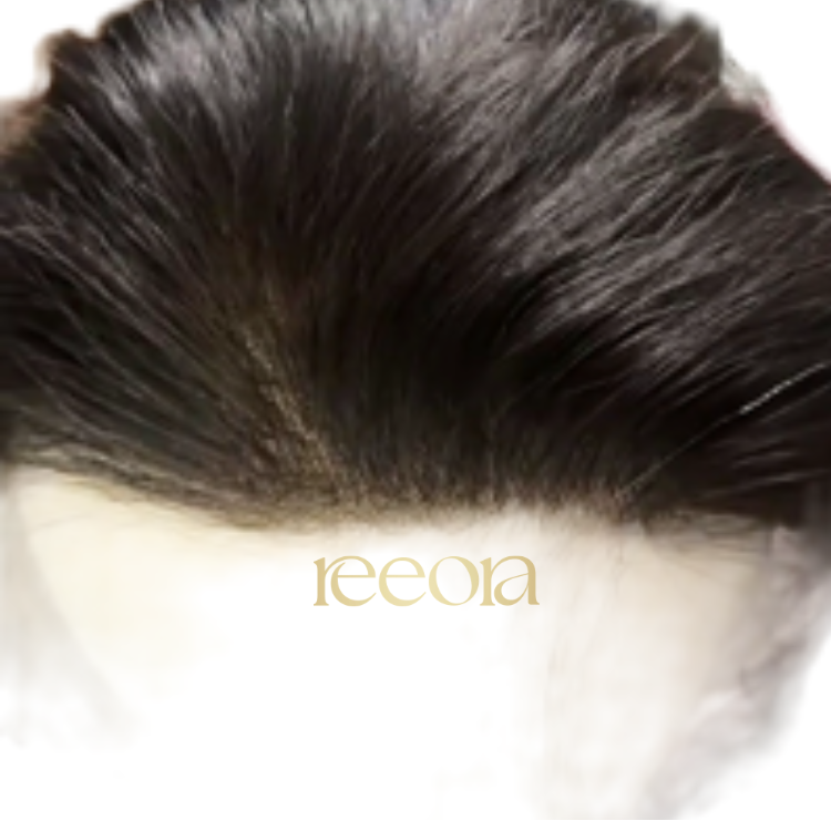 Receeding Hairline with Slim Topper