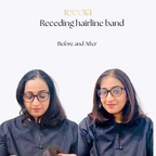 Frontal Receding Hairline band - Large & Small | 1.5 & 2.5 inch thick hair coverage bands | Clipless topper