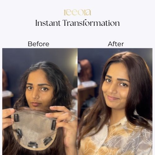 5x5 Skin Base Lace Front Human Hair Topper For Women I Natural Hairline I Hair Extensions